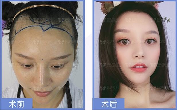 品質見證,“植”擊精彩 2019韓妃首屆發友會圓滿落幕!