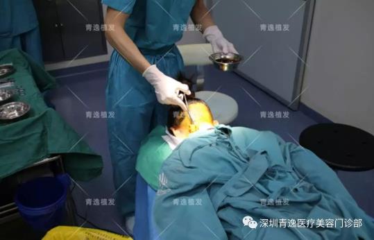 青逸植發(fā)醫(yī)院眾多醫(yī)生跟專家一同見證青逸咨詢助理唯唯的完美蛻變