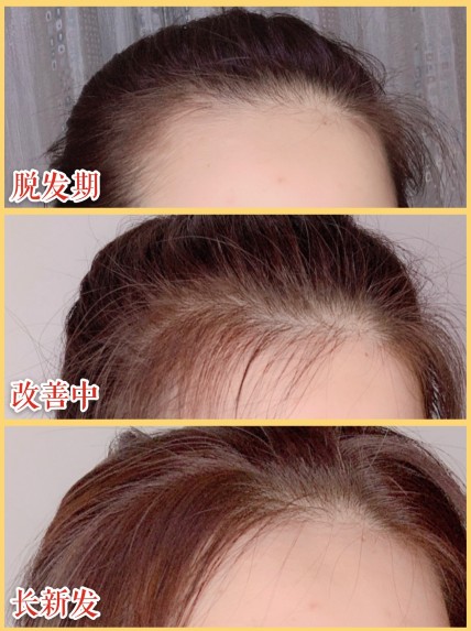 哪種洗發(fā)水好 學(xué)戚薇任性扎丸子頭少不了滋源