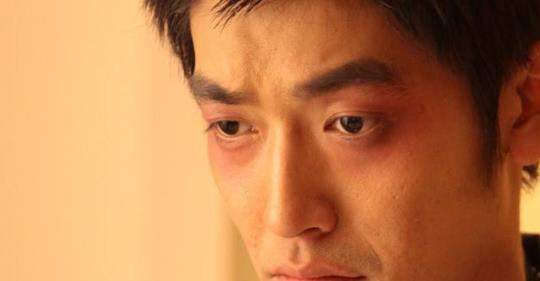 通過臉部4個信號可以看出男性健康 男性常吃5種水果更養生