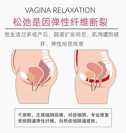 縮陰運(yùn)動(dòng)是怎么做的?(教程)