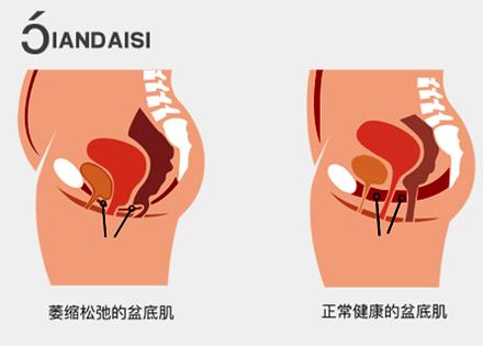 縮陰產品哪個牌子效果好?這幾個女人不能用!