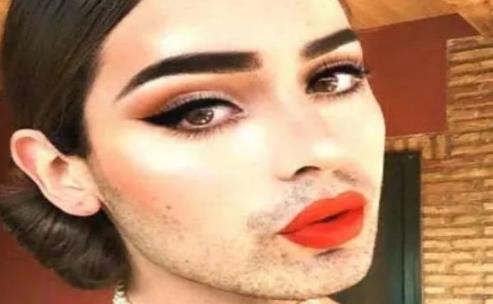 女生為什么長胡子?女生長胡子的原因有哪些