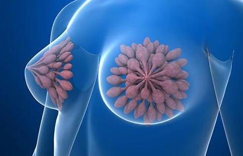單純的乳腺增生好治嗎?乳腺增生的高發人群