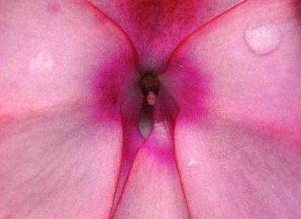 女性陰部真實(shí)照片:詳解健康女人真實(shí)完美陰道圖片【多圖】 女性陰部真實(shí)照片