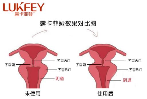 私護產品什么品牌好,首選國家最安全的私護產品