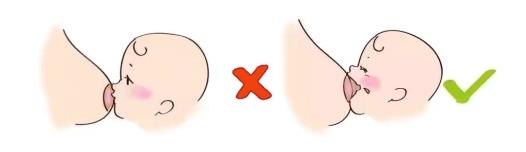 康哺樂®母乳益生菌預防、緩解哺乳期乳腺炎,全程守護母嬰健康!