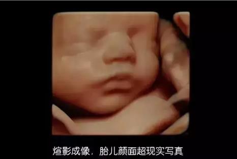 天津哪里做四維好?天津天孕醫院值得信賴