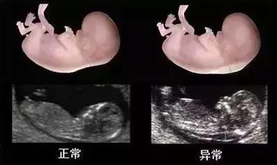 做四維去哪個醫院好?天津天孕醫院技術專業