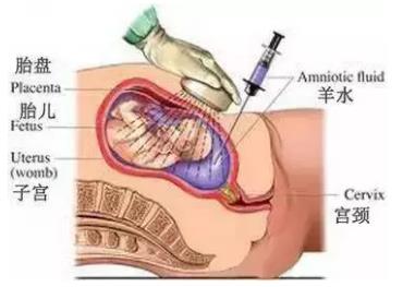 做四維去哪個醫院好?天津天孕醫院技術專業