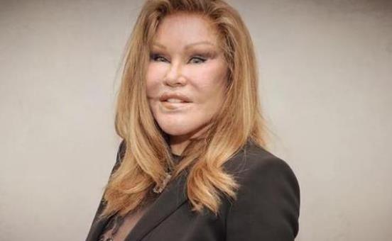 三、喬斯林威爾頓斯坦(JocelynWildenstein).jpg