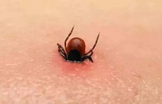 被蜱蟲咬了死亡率高嗎?被蜱蟲咬了一定會得病么?