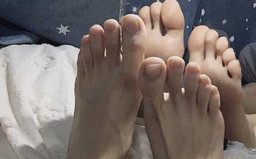 腳趾甲為什么會往肉里長 腳趾甲不好和肝臟有關系嗎