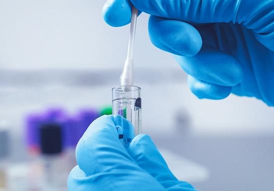 核酸檢測是不是在哪個小區都可以做?什么時候都可以做核酸檢測嗎?