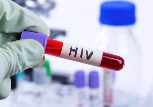 被惡意傳染艾滋病報警有用嗎?拍死蚊子的血會傳染艾滋病嗎