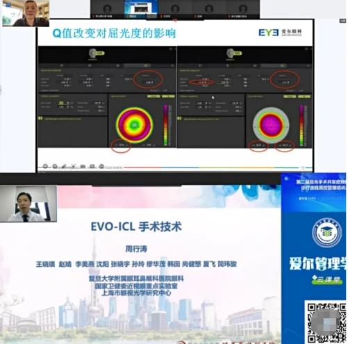 愛爾眼科屈光手術背后的“硬核”是什么?