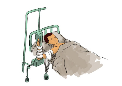 骨折病人吃什么好？骨折愈合的時間