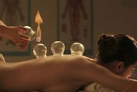 拔火罐能減肥嗎？拔火罐減肥的壞處