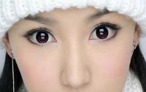 什么是韓式雙眼皮手術