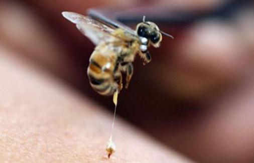 被蜂蜇了怎么辦？被蜂蜇的急救方法