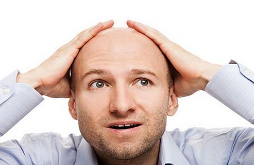 禿頂的原因 七個習慣防止男人禿頂
