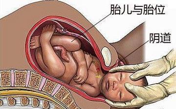 【分娩】分娩注意什么_分娩前的征兆_分娩視頻全過程_分娩后吃什么補身體 【分娩】分娩注意什么_分娩前的征兆_分娩視頻全過程_分娩后吃什么補身體
