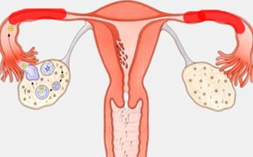 【女性生殖器結核】女性生殖器結核有哪些癥狀_女性生殖器結核如何治療_女性生殖器結核的原因 【女性生殖器結核】女性生殖器結核有哪些癥狀_女性生殖器結核如何治療_女性生殖器結核的原因