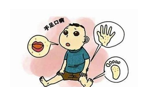 什么是手足口病？手足口病怎么治療