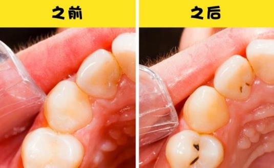女性在分娩之后會經歷7個不常見的身體變化