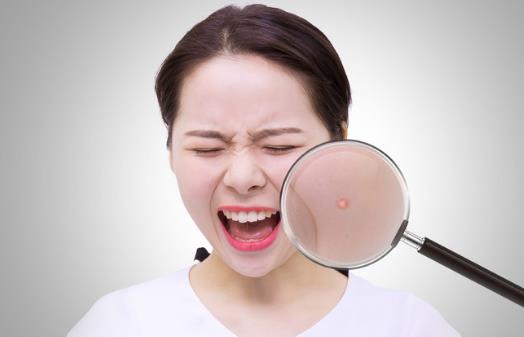 痘痘怎么消除，及時護理是必要的，如果臉上出現痘痘不要