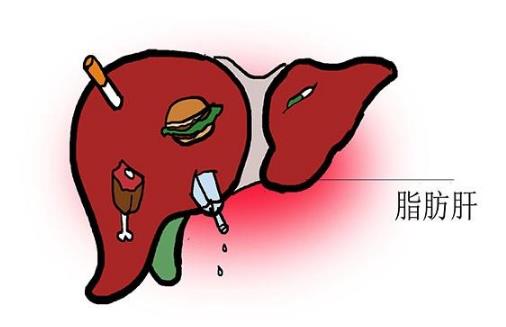 因為一件事，有人脂肪肝逆轉回正常，有人演變成癌！就怕