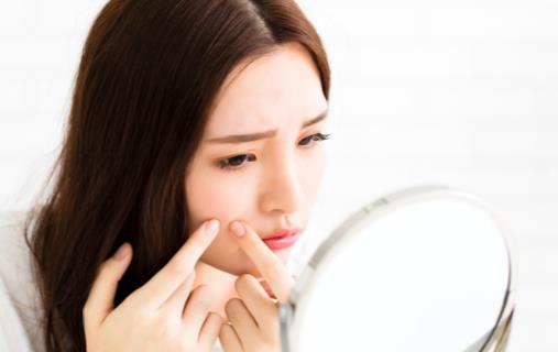 痘痘可以擠嗎 為什么會長痘痘