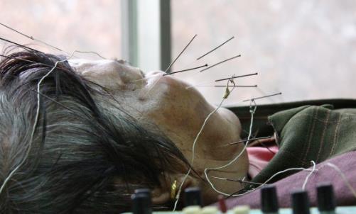 警惕！氣溫驟變，多人中招口眼歪斜、面部麻木……此季高