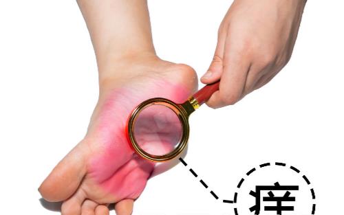 有腳氣的人，經常用鹽水泡腳就能消滅真菌嗎？它沒有這個