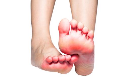 有腳氣的人，經常用鹽水泡腳就能消滅真菌嗎？它沒有這個