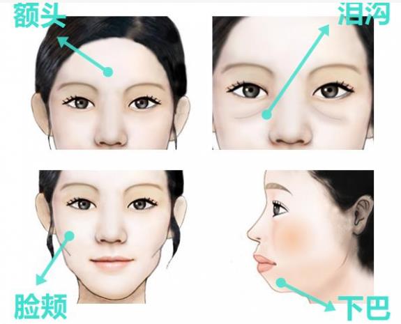 韋元強講解：瘦子也適合做自體脂肪填充嗎？