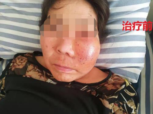 鄭州京美醫院腫瘤科好嗎？中醫專家 微創聯合治療