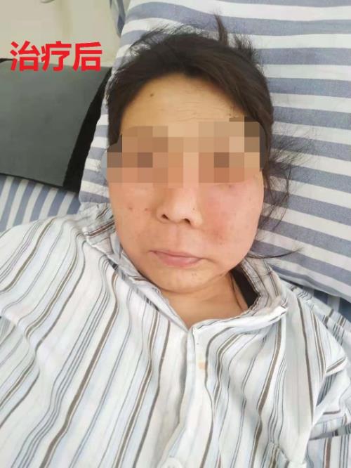 鄭州京美醫院腫瘤科好嗎？中醫專家 微創聯合治療
