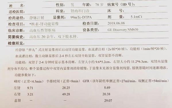 青島靜康醫院案例：明明是重度腎衰,血肌酐卻正常!化驗單會說謊嗎?