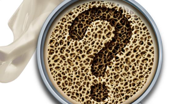 骨質(zhì)疏松的10個(gè)認(rèn)知誤區(qū)，你中了沒(méi)？