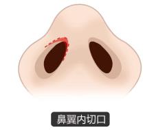 北京圣慈整形醫(yī)院鼻子王王軍怎么樣？專(zhuān)業(yè)實(shí)力 讓你放心美