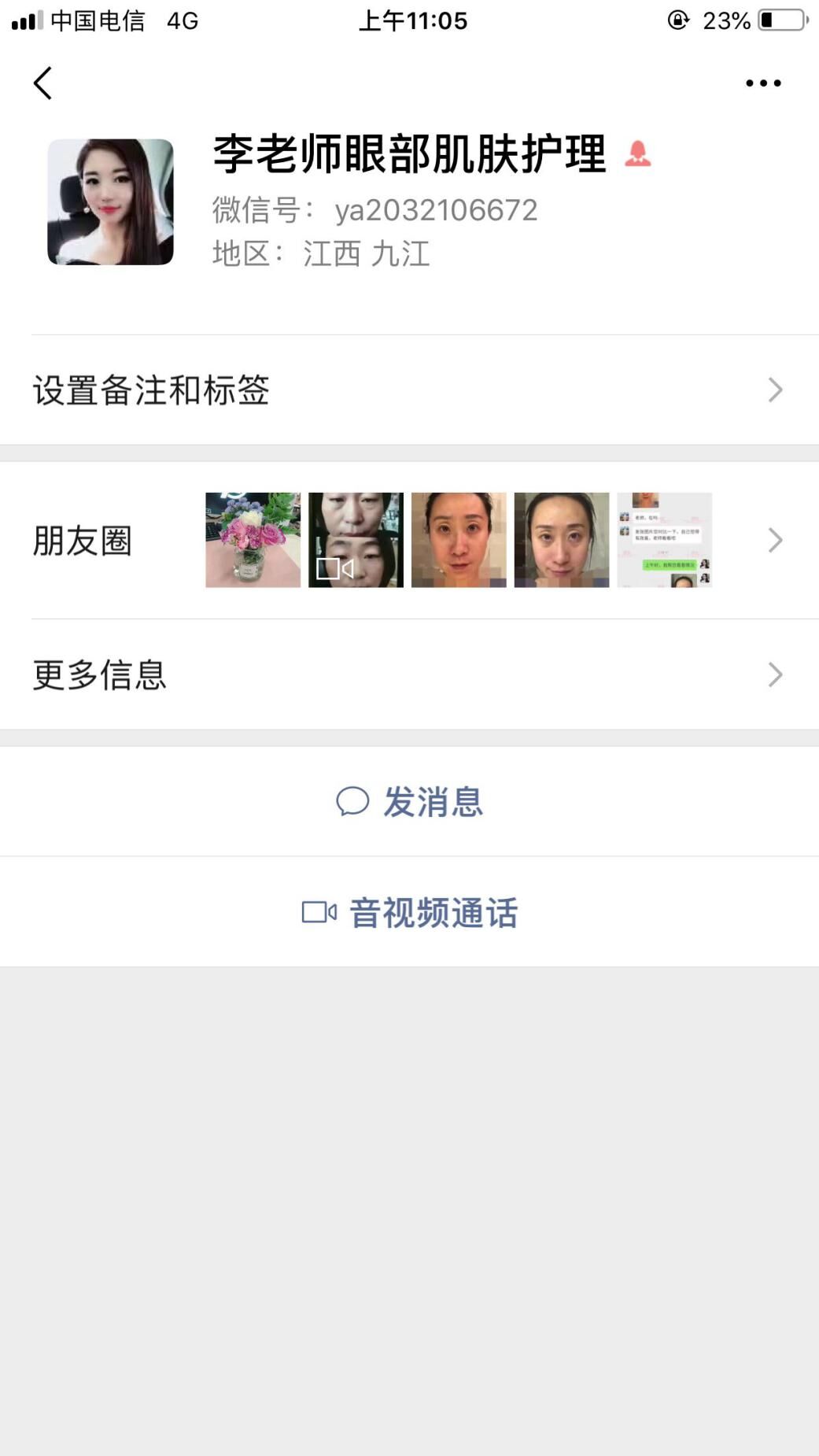 衛婭日記：我一直都以為眼袋對我的影響只是美觀，直到我了解了以后……