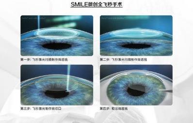 西安普瑞眼科醫院治療近視好？參軍入伍，近視手術提前半年做準備