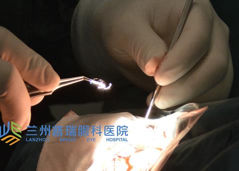 蘭州普瑞眼科治療白內障怎么樣？預防白內障從年輕開始