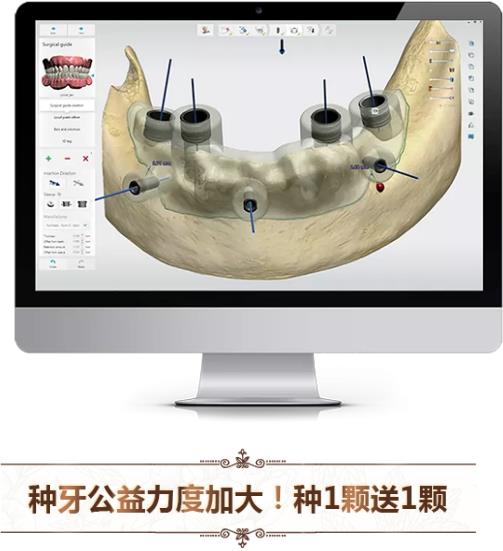 中家醫口腔全民愛牙公益行動：德國智能種植牙更靠譜