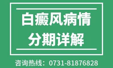 婁底白癜風醫院專家病情階段分期詳解